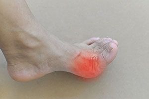 Foot & Ankle Tendinitis