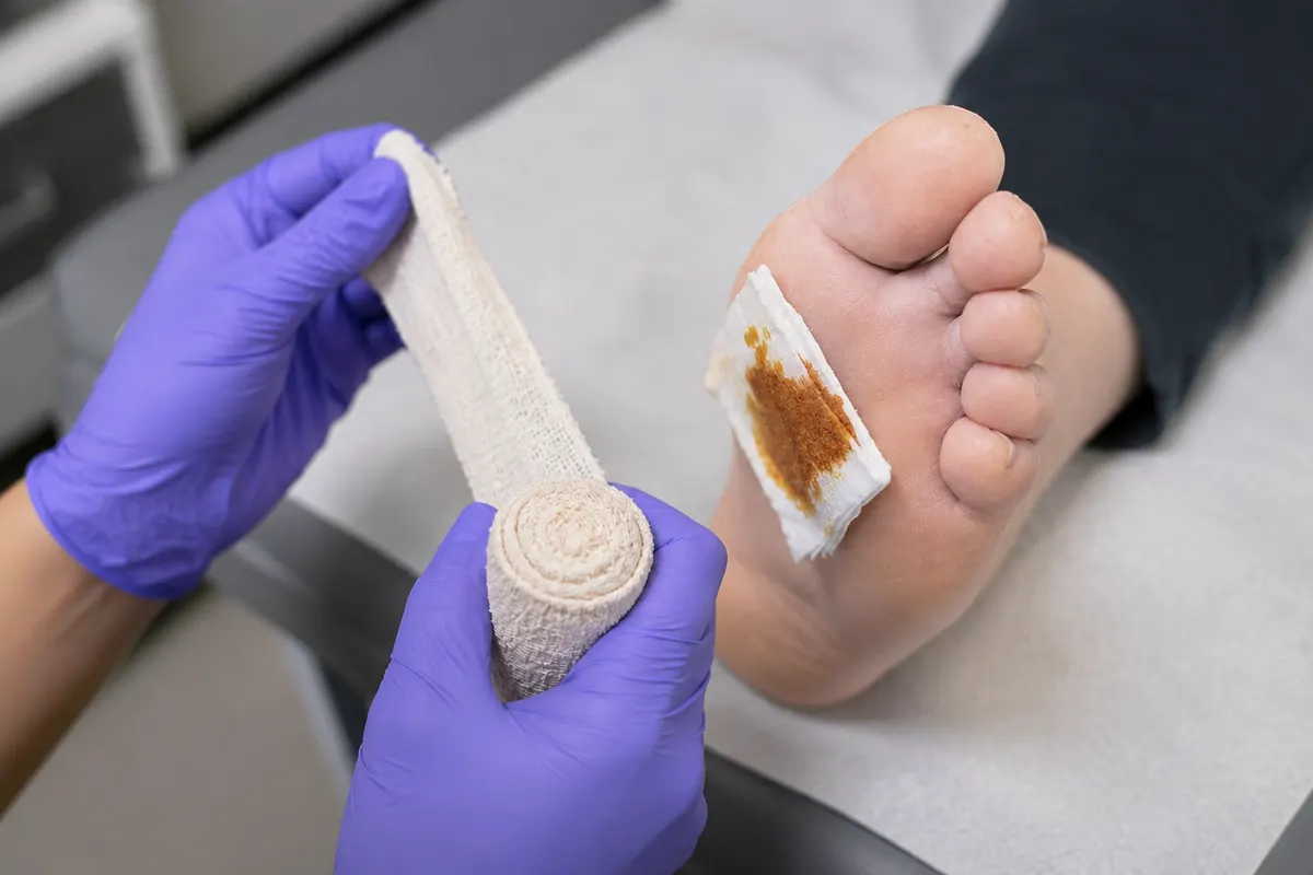 Wound care